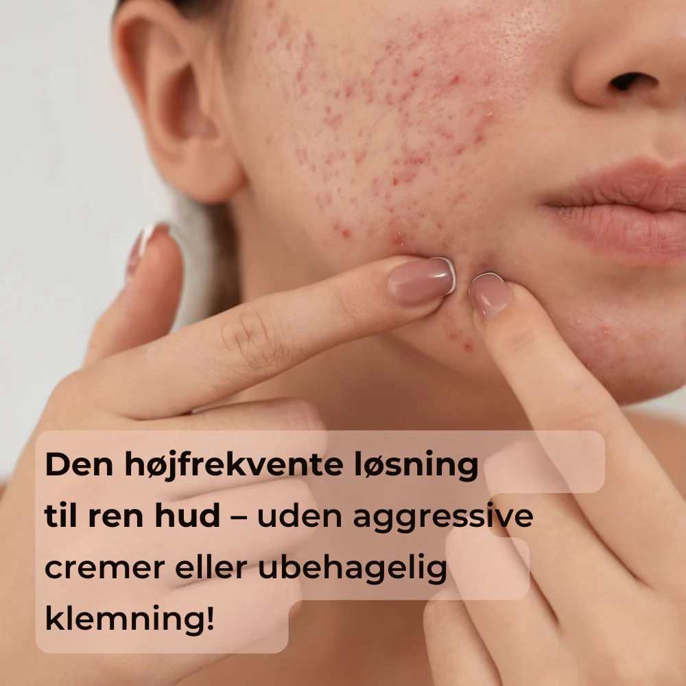 AcuDerma Aknebehandling
